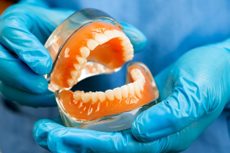 Protezy overdenture - komfort i stabilność dla pacjentów